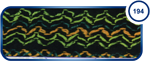 194